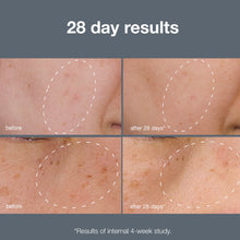 Load image into Gallery viewer, Powerbright Dark Spot System