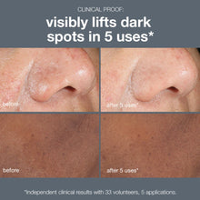 Load image into Gallery viewer, Dermalogica Powerbright Dark Spot Peel