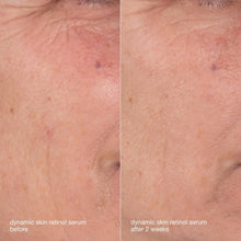 Load image into Gallery viewer, Skin Aging Solutions Kit