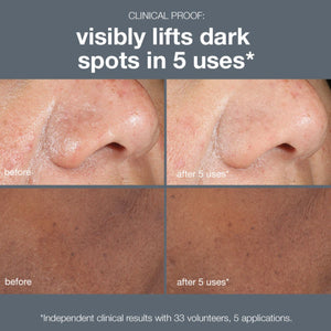 Powerbright Dark Spot Peel